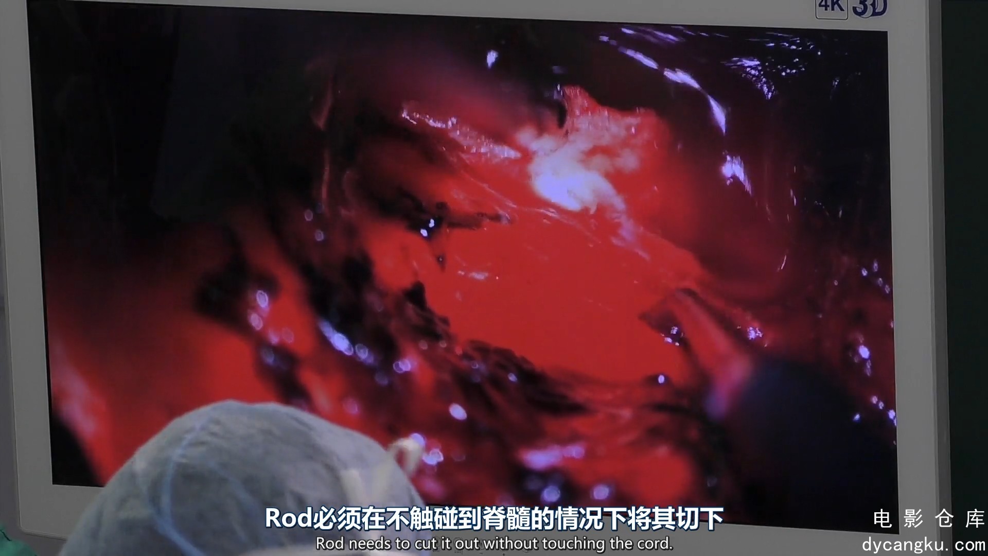 [电影仓库dycangku.com]手术室的故事Surgeons.At.the.Edge.of.Life.S04E02.1080p.mp4_.jpg